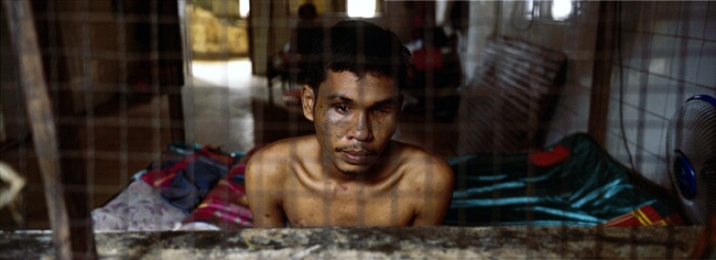 Land Mine Victim, Phnom Penh Military Hospital