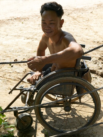Land mine victim at Choeung Ek, sometimes called the Killing Fields, near Phnom Penh, Cambodia